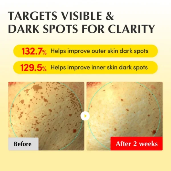 كريم تفتيح وترطيب وتوحيد البشرة EQQUALBERRY Vitamin Illuminating Cream - منتجات كورية