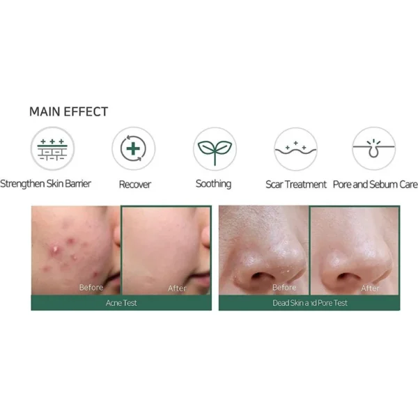 كريم علاج الحبوب و تقشير البشرة SOME BY MI AHA BHA PHA 30 Days Miracle - منتجات كورية