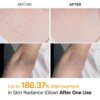 بخاخ مقشر للجسم بحمض الكوجيك والكركم Dr. Melaxin Peel Shot Exfoliating Spray - منتجات كورية
