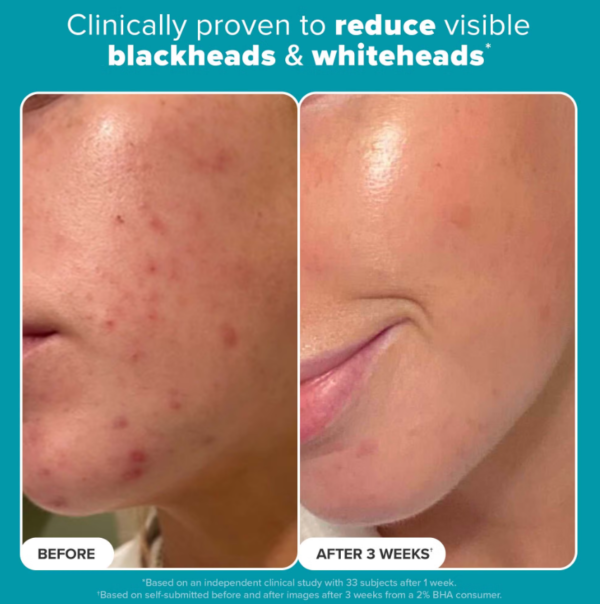 تونر مقشر بحمض الساليسيليك Paula’s Choice Skin Perfecting 2% BHA Liquid Exfoliant - منتجات كورية