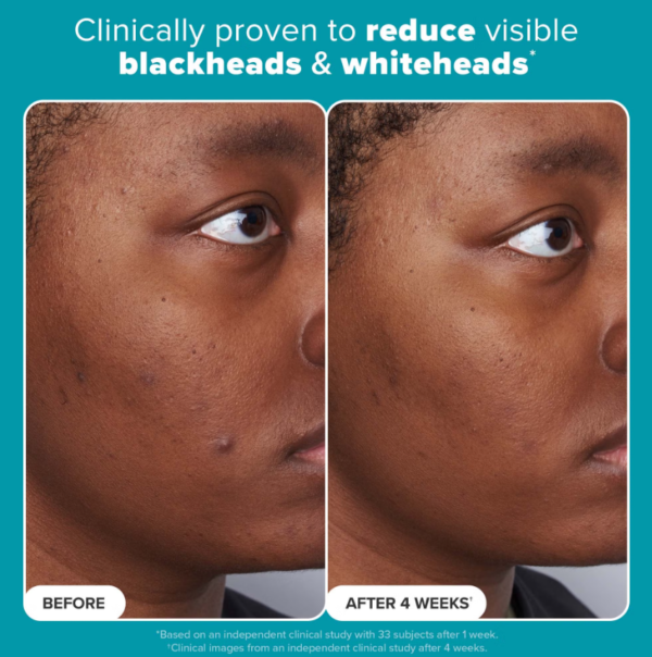 تونر مقشر بحمض الساليسيليك Paula’s Choice Skin Perfecting 2% BHA Liquid Exfoliant - منتجات كورية