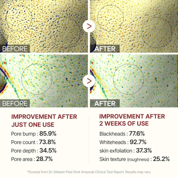 سيروم تقشير وتفتيح البشرة Dr. Melaxin Peel Shot White Rice Exfoliating Ampoule - منتجات كورية (5) سيروم الارز تقشير وتفتيح البشرة Dr. Melaxin Peel Shot White Rice Exfoliating Ampoule - منتجات كورية