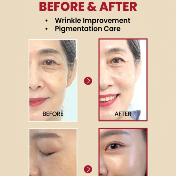 سيروم ريتينال وجنسنغ لتجاعيد وشد Seoul 1988 Retinal & Black Ginseng Serum - منتجات كورية (7) سيروم ريتينال وجنسنغ لتجاعيد وشد Seoul 1988 Retinal & Black Ginseng Serum - منتجات كورية