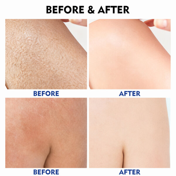 لوشن ترميم وتجديد البشرة ليلاً  Kiss Beauty Gluta-Hya Overnight Radiance